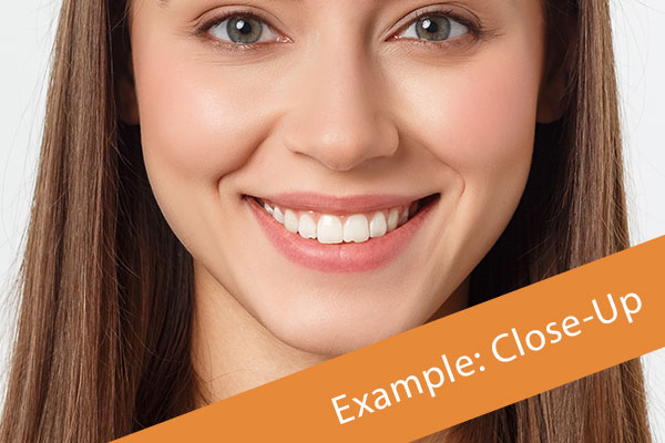 Smile Close-Up Example Image